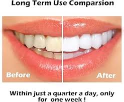 Herbal Teeth Whitening